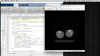 Automatic Segmentation and Reconstruction Algorithm