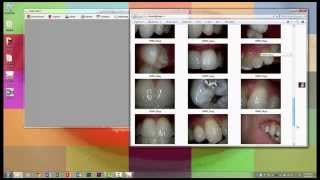 md960u Dental USB intraoral camera software use with Windows 7 Photo viewer