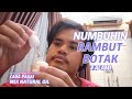 Cara Gue Memakai Mix Natural Oil Untuk Kebotakan