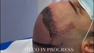 Trico in Time-Lapse - TricoSolution