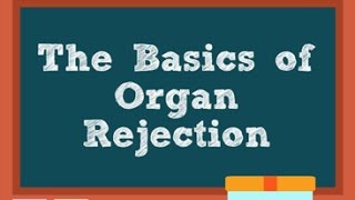 Basics of organ rejection
