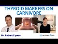 Hypothyroid on Carnivore. Low T3 on Carnivore. Thyroid Markers on Carnivore with Dr. Robert Cywes