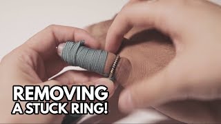 HOW TO REMOVE A RING STUCK ON A FINGER!