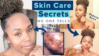 20 Skincare Secrets NO ONE TELLS YOU | NO MORE Blackheads, Acne Scars & Hyperpigmentation