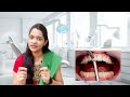 how to tighten loose teeth or mobile teeth in telugu ఊగే పళ్లకు ట్రీట్మెంట్