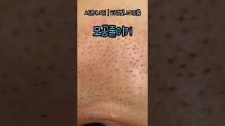 플라즈마블라스트 모공관리 plasmablast