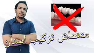 3 حالات مينفعش تعمل فيهم تركيبه ثابته لاسنانك تعرف عليها