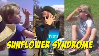 Sunflower Syndrome