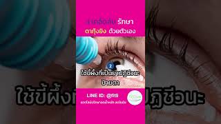 4 เคล็ดลับ รักษา “ตากุ้งยิง” ด้วยตัวเอง #ตากุ้งยิง #ต่อมไขมัน #อุดตัน #ติดเชื้อ #อักเสบ #บวมแดง