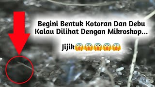 Tumpukan Kotoran Dan Debu, Jika Dilihat Dengan Mikroskop, Beginilah Bentuknya... Aneh Banget😱