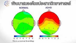 เล็ก ๆ เปลี่ยนโลก [by Mahidol] พัฒนาสมองด้วยประสาทวิทยาศาสตร์