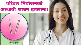 परिवार नियोजनको अस्थायी साधन ईम्प्लान्ट के हो?Pariwar Niyojanko asthai sadhan #Implant_Norplant.