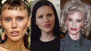 You Wonāt Believe How BAD These Celebs Look Now