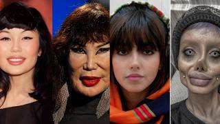 What Happened To These Celebrities Shocking Transformations Explained