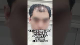 급히 가발이 필요하신분 나노스킨 인모가발