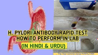 H.pylori antibody test how to perform in lab.Test to check treatment of infection.(Urdu & Hindi)