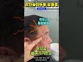 만성 관자놀이 두통😖 관자놀이 물렁물렁 머리아플때 mri 검사해도 이상없는 관자놀이 두통 눈알이 빠질듯 아플때 측두동맥염 i 루이빈치과 류지헌 원장