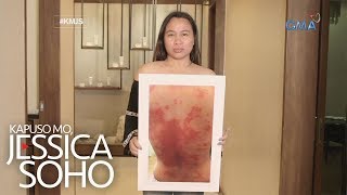 Kapuso Mo, Jessica Soho: Ilang kababaihan, nabiktima diumano ng pekeng beauty products