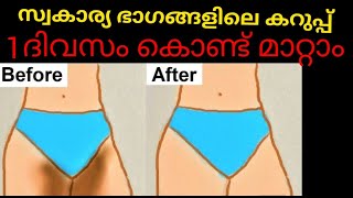 സ്വകാര്യ ഭാഗങ്ങളിലെ കറുപ്പ് മാറ്റാൻ 1ദിവസം NaturalPack കൊണ്ട് How to Lighten your Private area