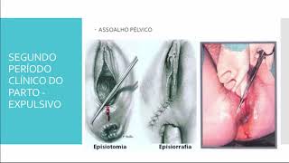 Períodos Clínicos do Parto