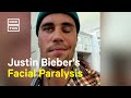 Justin Bieber Announces He Has Ramsay Hunt Syndrome