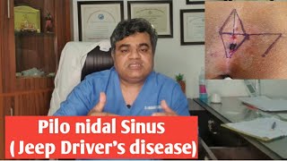Pilonidal sinus(Jeep Drivers Disease) Everything You Wanted To Know- Dr Anshuman explains!