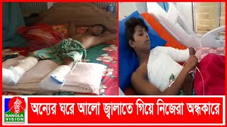 পিডিবির লাইনম্যানের ভুলে জীবন শঙ্কায় ২ যুবক | BVNEWS24