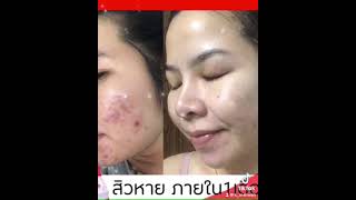 ครีมซีรีย์ยู สูตร3