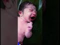 a newborn baby after birth delivery crying shorts baby viral