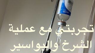 تجربتي مع عملية #الشرخ #البواسير