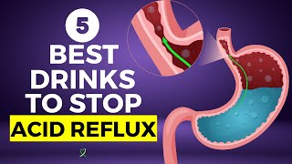5 Best Drinks To Stop Acid Reflux