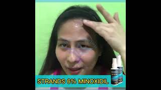 Strands Minoxidil Testimonial Satisfied user!