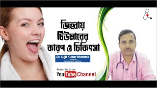 জিহ্বায় টিউমার হওয়ার কারণ ও চিকিৎসা। (Tumor on the tongue)@healthtips2022