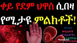 ቀይ የደም ህዋስ ሲበዛ የሚታዩ ምልክቶች | Signs and Symptoms of Excess  Red Blood Cells 💚💛❤Amazing Video #rbc