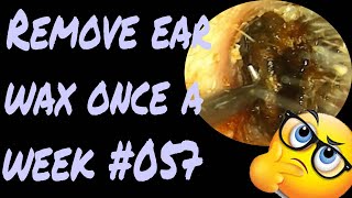 Remove ear wax once a week​ #057