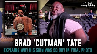 UFC 'Cut Man' Brad Tate Explains Viral Photo: Latex Gloves Are the Culprit For My Ashy Hands!