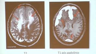 HCPA - Grand Round - Sessão Clínico-radiológica