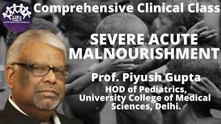 SEVERE ACUTE MALNUTRITION Clinical Case presentation