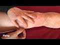 Needle Technique in Traditional Chinese Medicine - if you don’t get deqi - Danny Blyth