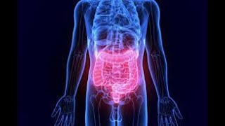 Inflammatory Bowel Disease (USMLE): How to differentiate Ulcerative Colitis and Crohn's Disease