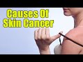 6 Unusual Causes For Skin Cancer You Should Know | Boldsky