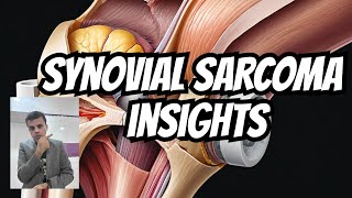 Synovial Sarcoma: Types, Prognosis, and More with Dr. Shashikant Adlekha #pathology