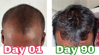 #Hair_growth \u0026 ஆரோக்கியத்திற்கு சிரசாசன சிகி.. 90 நாள் உணவு மற்றும் உணர்வின் பகிர்வு