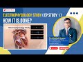 Electrophysiology study ( EP Study 1) How it is done? | Dr Ashutosh Kumar