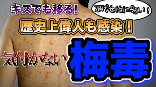 【梅毒】キスで移る性病！産婦人科医上村茂仁が正しい性感染症の知識をわかりやすく解説！