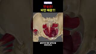 비만을 방치하면 생기는 일 #변실금