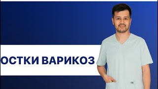 Остки варикоз