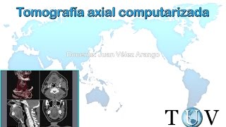 Tomografía axial computarizada TAC - Herramientas para examinar el cuerpo humano