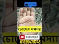 চোখের সমস্যা eye problem viralvideos shortvedio palmistry shorts viralreels