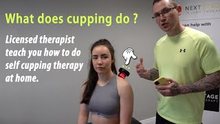 What does cupping do ? Licensed therapist teach you how to do self cupping therapy at home.